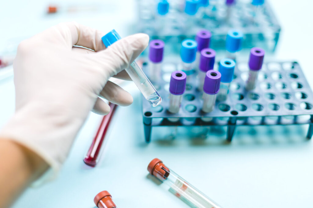 Doctor with medical glove handling a vial with medical samples in the analysis laboratory